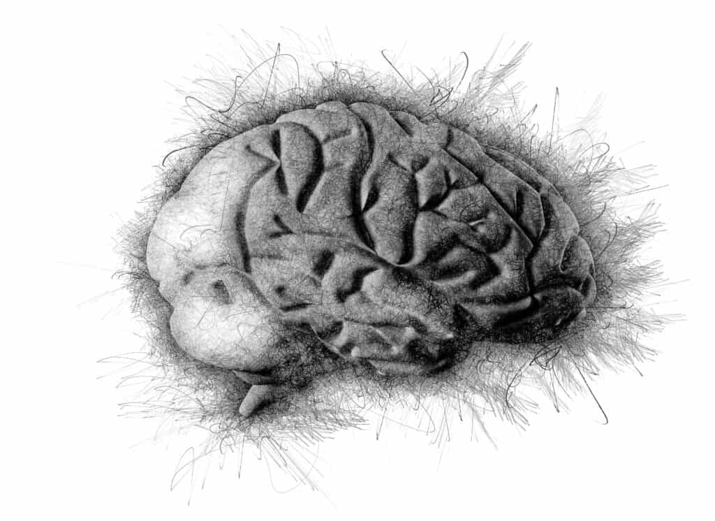 dog brain